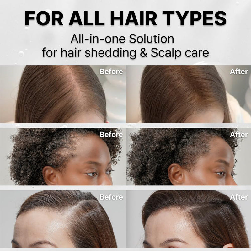 Elixora RevivaRoot™ Serum