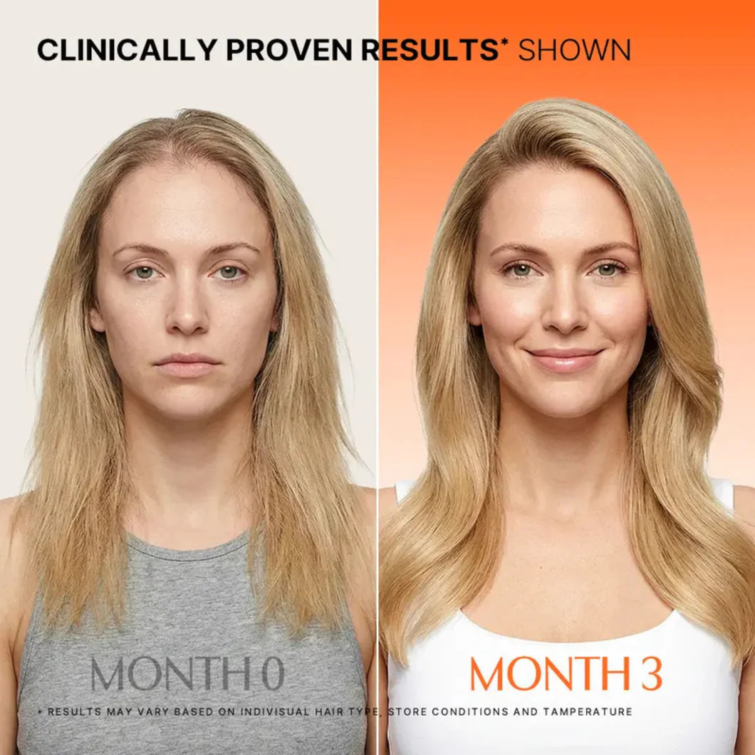 Elixora RevivaRoot™ Serum