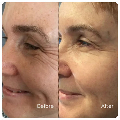 Elixora™ Peptide Lifting Ampoule