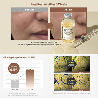 Elixora™ Peptide Lifting Ampoule